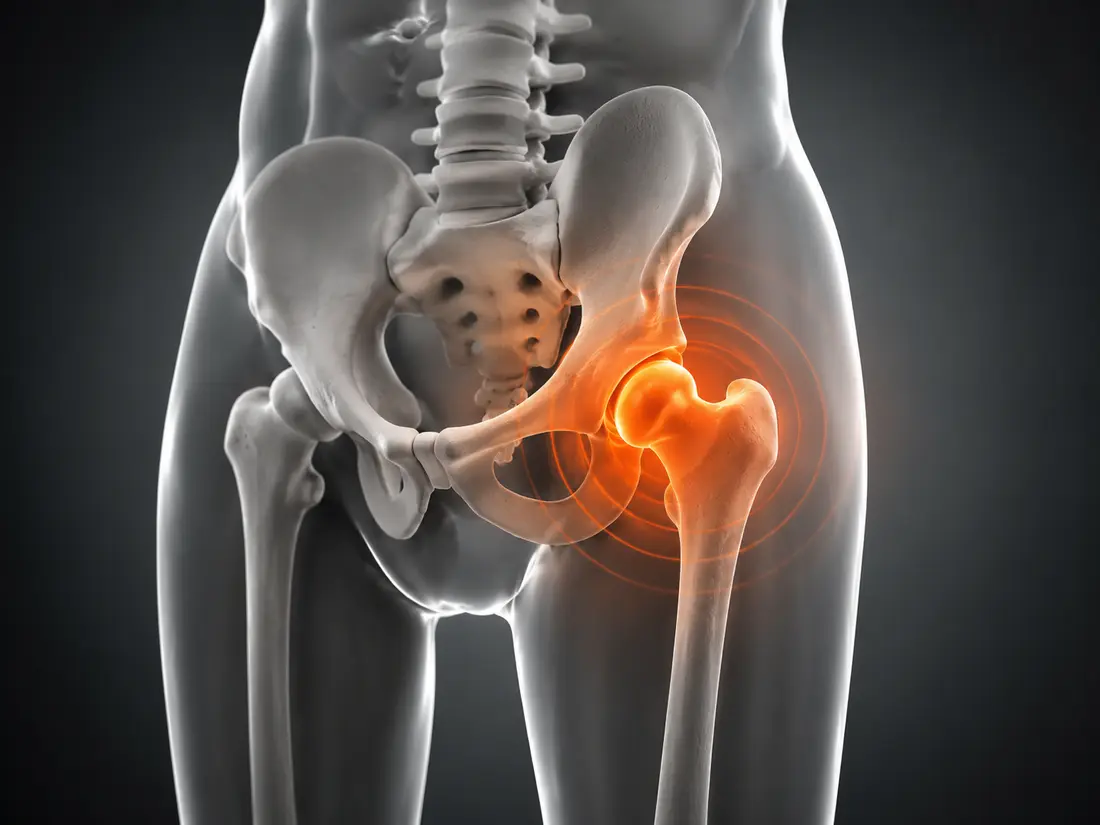 Modern medical illustration highlighting the hip joint