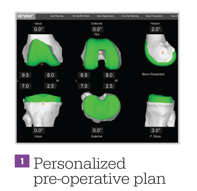 Robotic assisted hip surgery